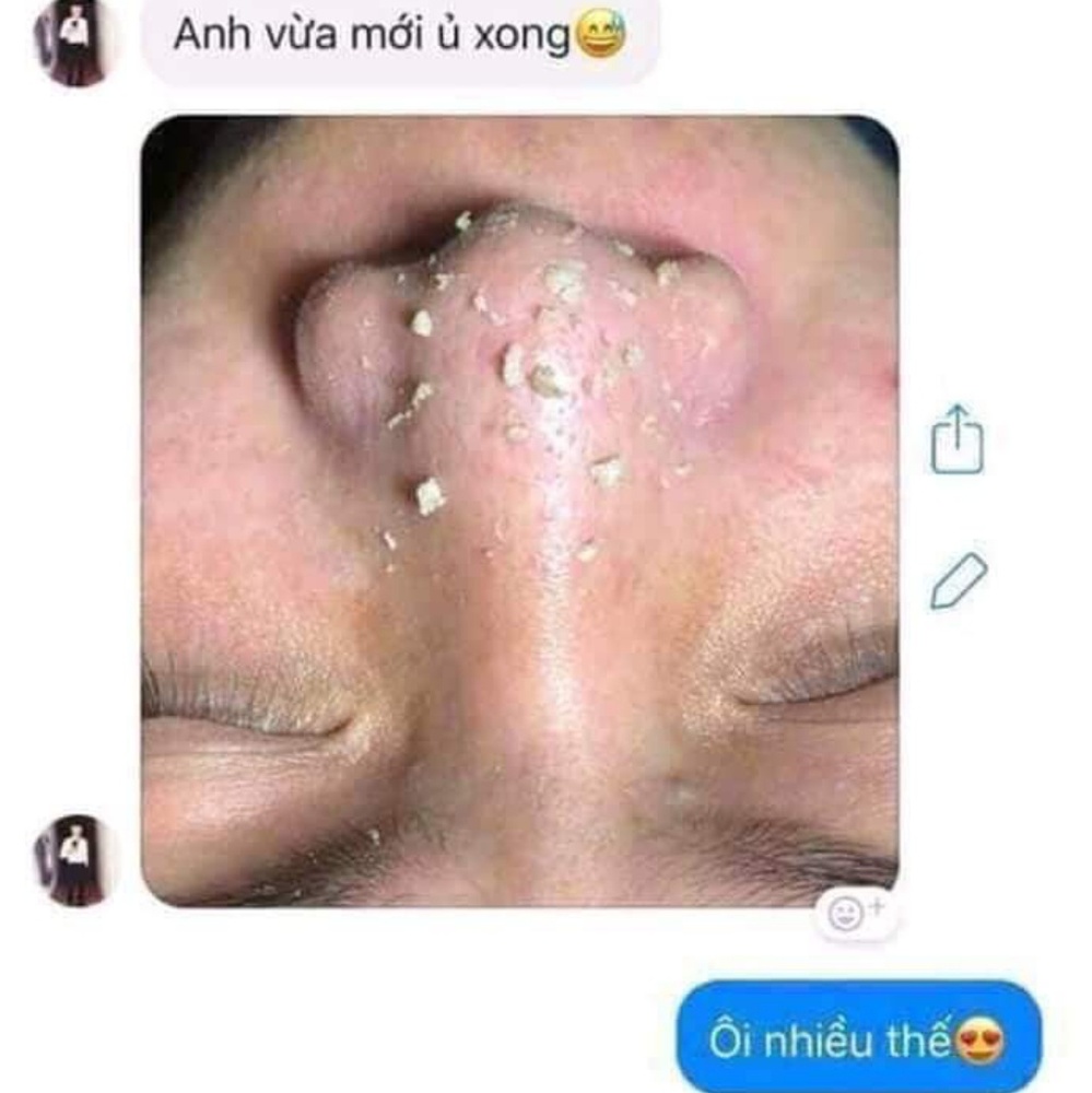 OHIO hangul ByeBye blackheads